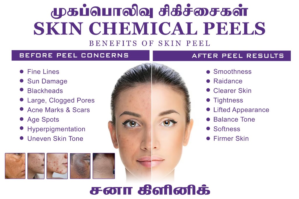 Chemical Peel Awareness